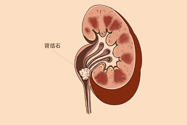 血压|血压的正常值是多少？为什么美国高血压标准比我国低？医生告诉你