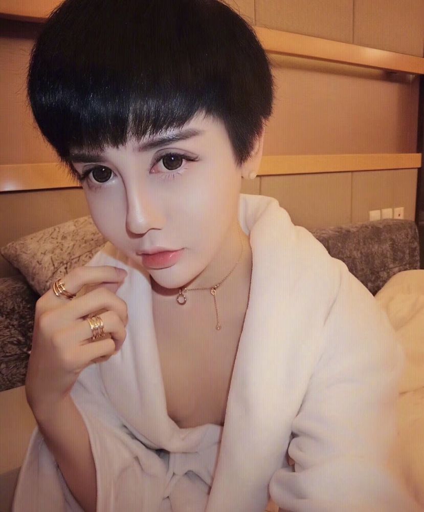 美女网红嘴唇肿得像香肠五官比例失调,被嘲整容过度