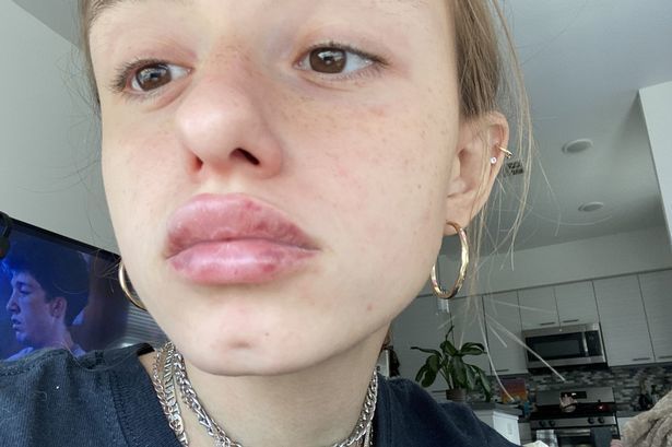 整容带来的蜜汁审美女孩把自己整成怪物公司里的香肠嘴真菌怪