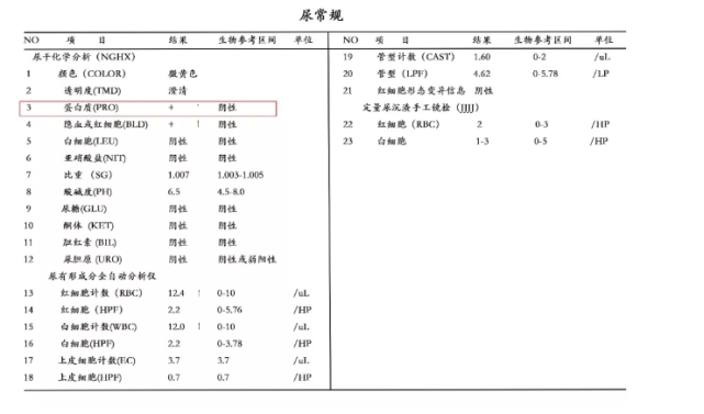 箭头高高低低看不懂 不懵圈 不求人 一篇教你看懂尿常规 尿液 高高 糖尿病 尿比重 尿胆红素