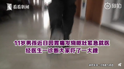 胃镜|男孩一年来肚子疼还老吐，胃镜一照竟有两枚硬币：过年吃饺子时误吞