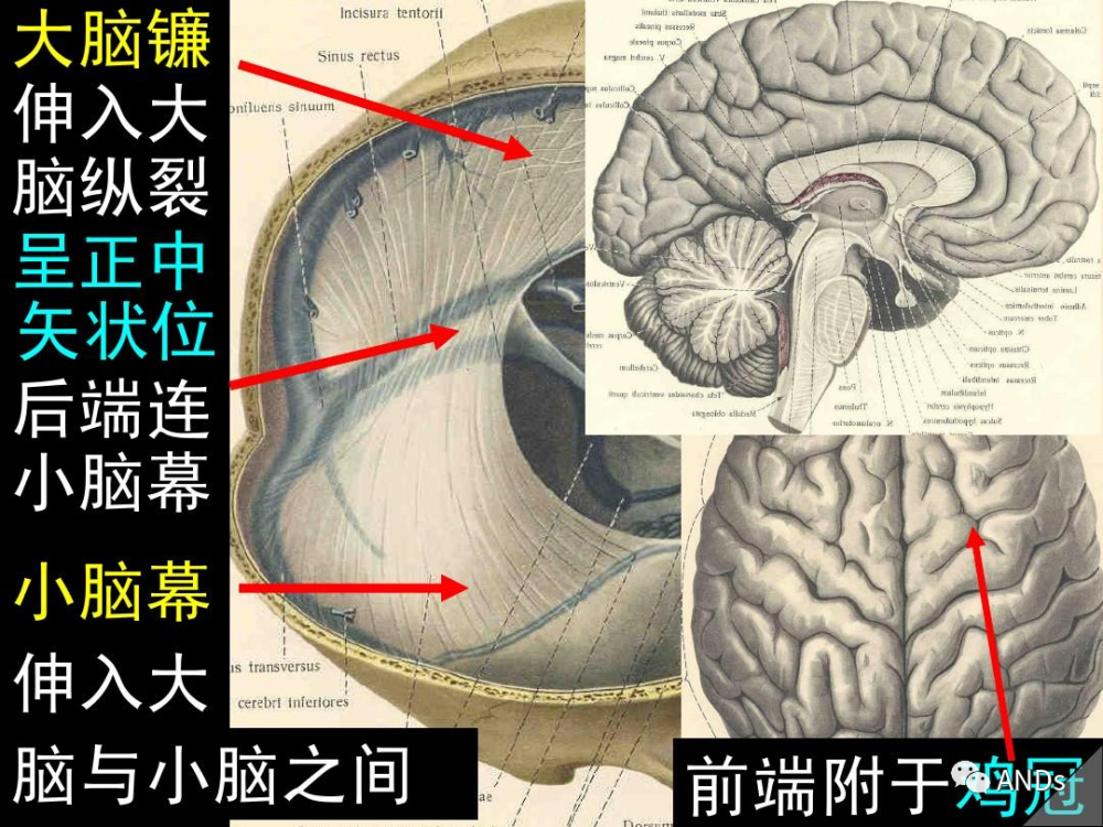 脑室/脑池/脑膜精细解剖图谱_腾讯新闻