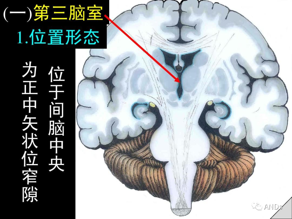 脑室系统 侧脑室 第三脑室 第四脑室(第五脑室 第六脑室 中脑水管