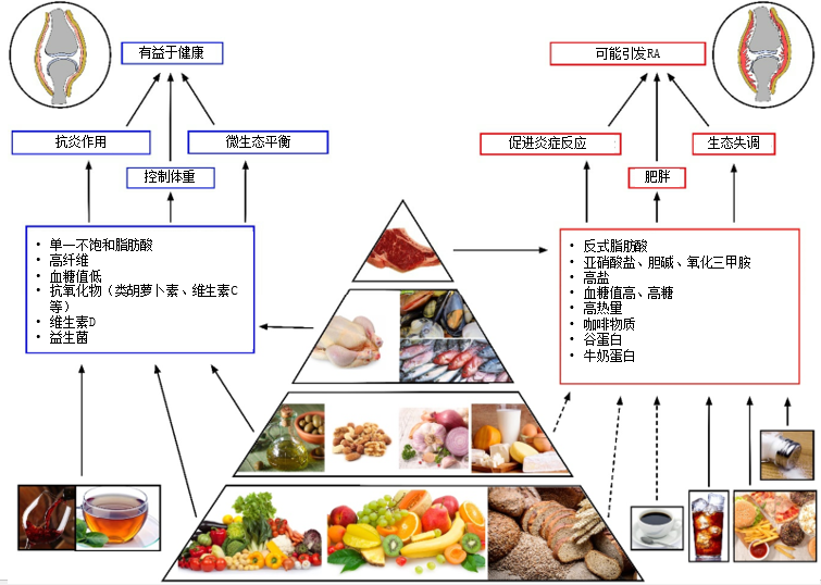 类风湿关节炎|当“李焕英”遇上RA，四个条目要记牢