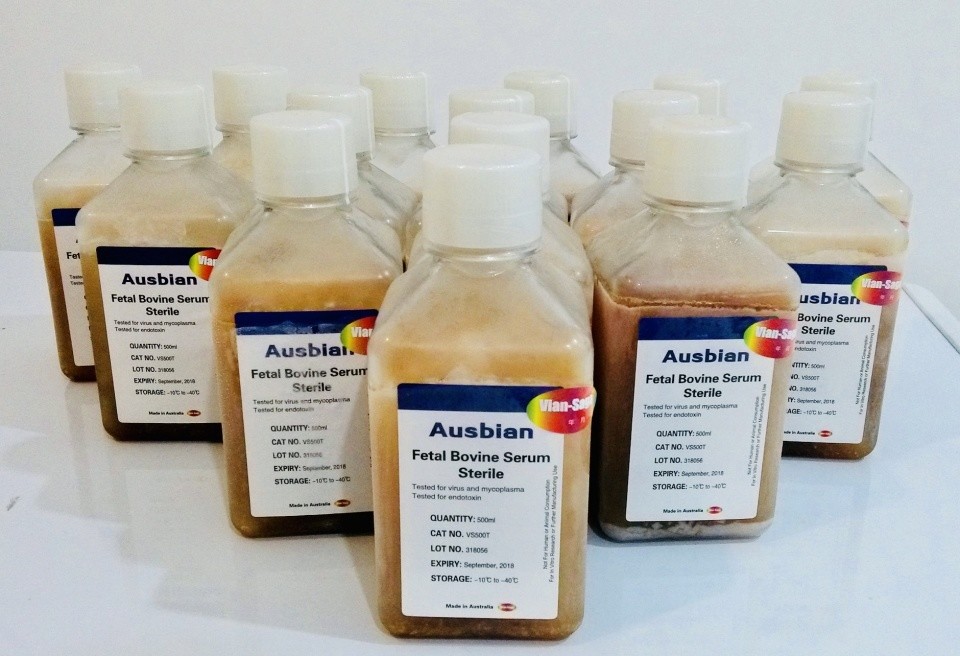 大脑|研究人员已经弄清楚了如何在体外维持大脑和神经组织的生命