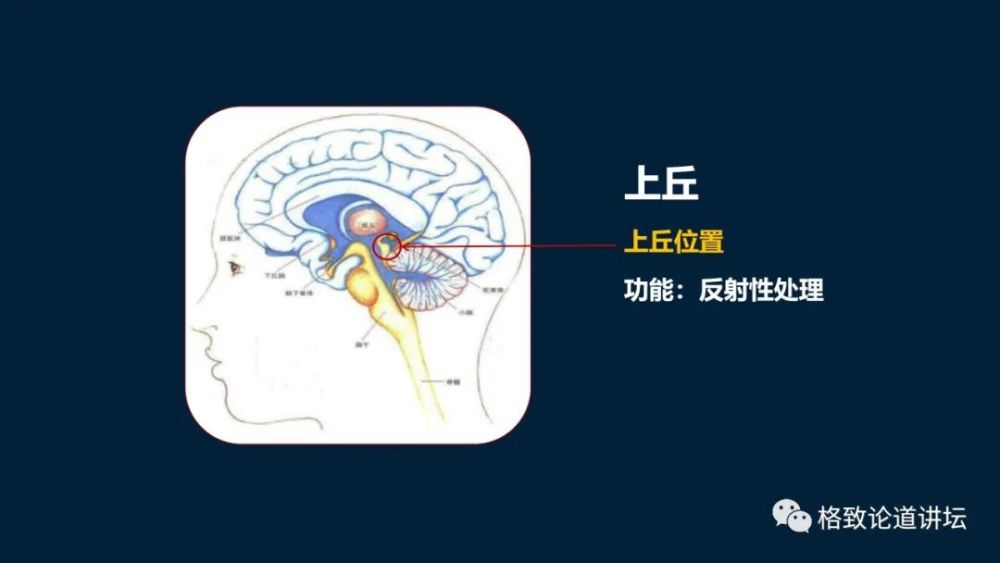 大脑|机器人的寒武纪要来了？仿制人眼，相当于仿制了人类的整个大脑？