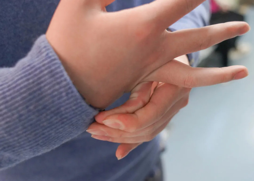 成都一小伙"特异功能"手指可任意折叠!医生:这是病得小心