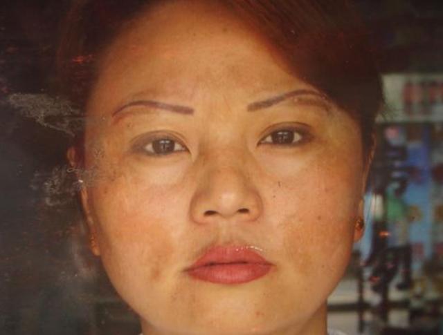 女性都非常的苦闷,这些难看的斑点在自己的脸上,看上去真像一个黄脸婆