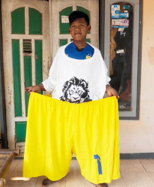 体重|世界最胖男孩：11岁体重超384斤，如今减到167斤，以前衣服大如麻袋