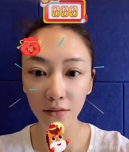 应采儿脸上扎满了针