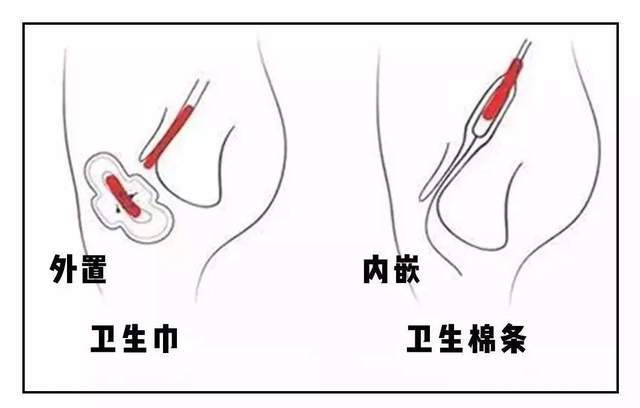 这4个关于卫生巾的小知识,为了健康,也该了解一下