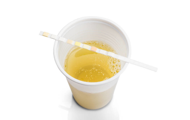 降尿酸|有什么降尿酸的好方法？饮食运动用药，一文全总结，建议收藏