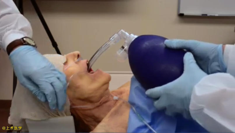 喉罩|喉罩使用方法大全