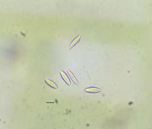 葡萄|权威发布：葡萄溃疡病的发生与防治措施