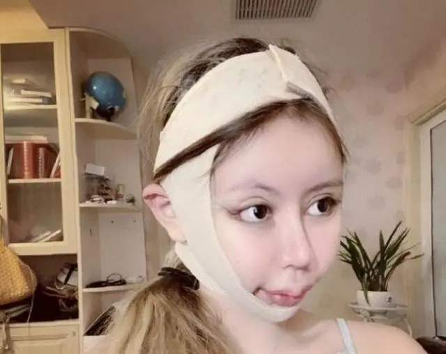 "花费近百万",3年整了60次的网红女孩如今怎样?前后判若两人