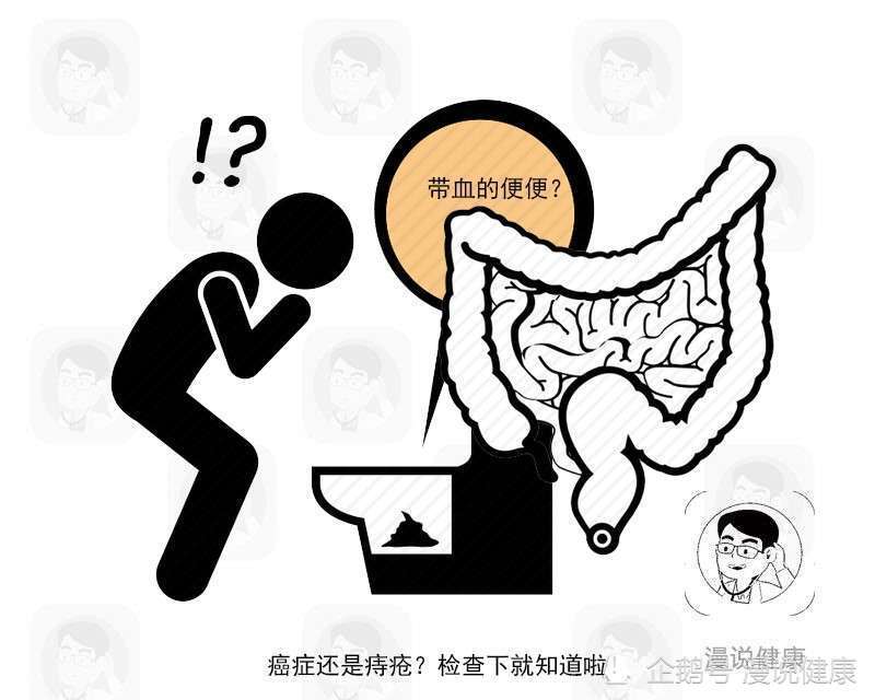 胰腺癌|胰腺癌来临，饭后往往会出现4个“信号”，若你全占，最好去检查