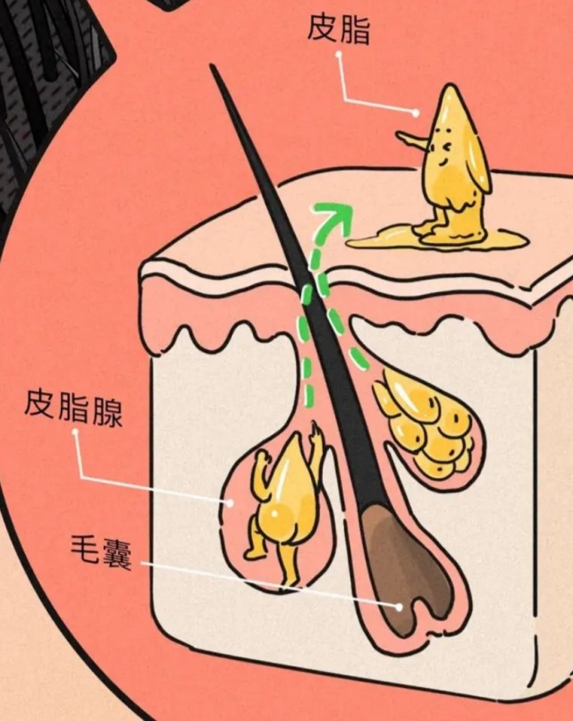 脱发就不一定了 头发源于毛囊,那是生它,养它的地方 毛囊还连着皮脂腺