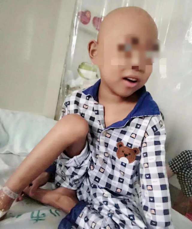 5岁娃脖子肿一查竟是白血病有这5种症状一定要重视