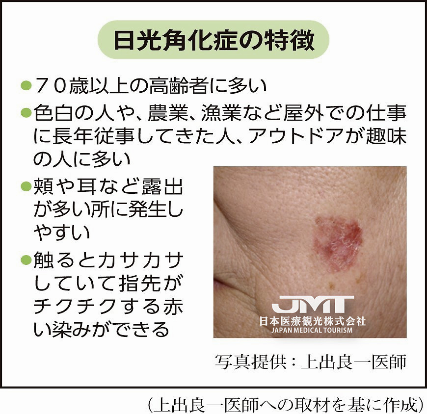 Jmt因紫外线的刺激而发病的光化性角化病 放任不管的话有癌变的危险 腾讯新闻