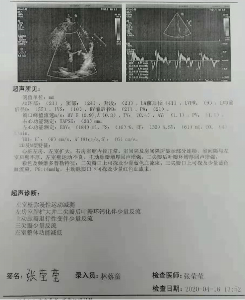 nstemi|【华医大查房】急性NSTEMI处理过程（一）