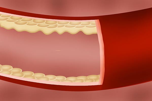 喝酒|俗话说“酒为百药长”，活血化瘀，每天喝1两酒，身体会获益吗？