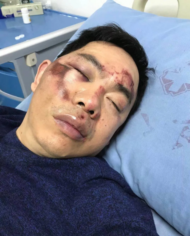 处理决定来了达州两男子酒后殴打出租车司机行政拘留13日罚款