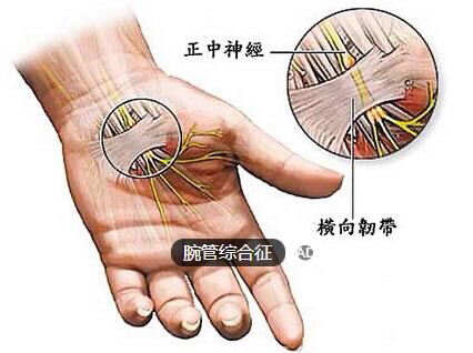 左手食指神经图图片