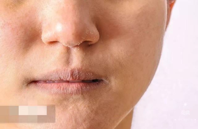 不洗脸,却是护肤?越护肤但皮肤越来越差的是不是你(内调篇)