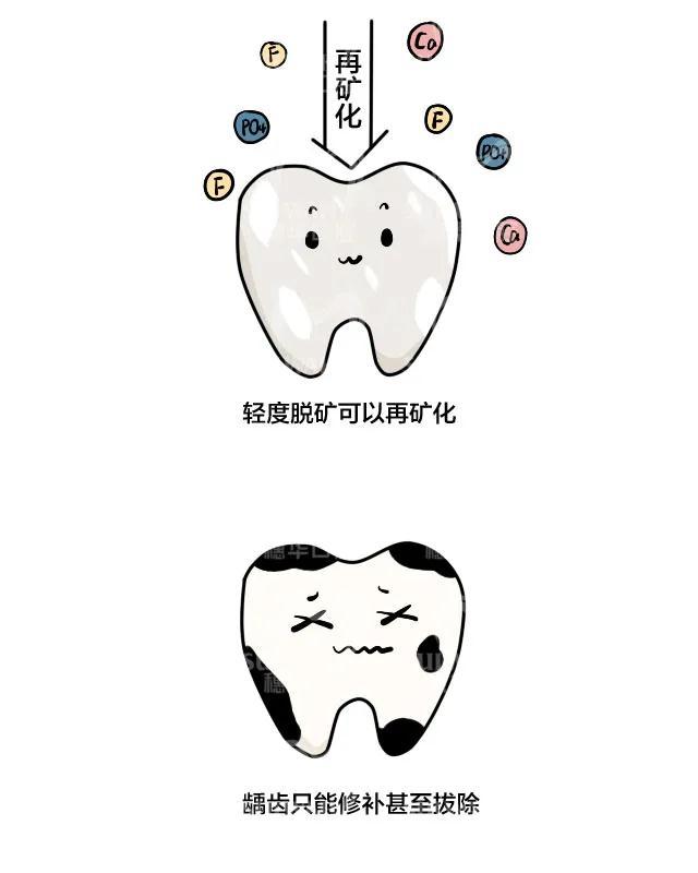 正畸與牙齒脫礦有什麼聯繫呢