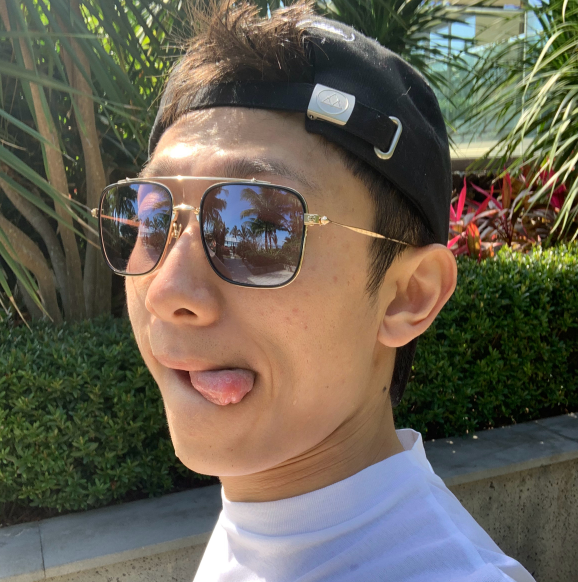 张一山晒旅游照墨镜中倒映出一条女生的手臂在阳光下白到发光