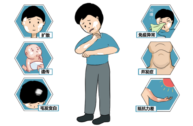 生活質量卻在逐步降低.患者的看病成本提高白斑擴散跡象明顯