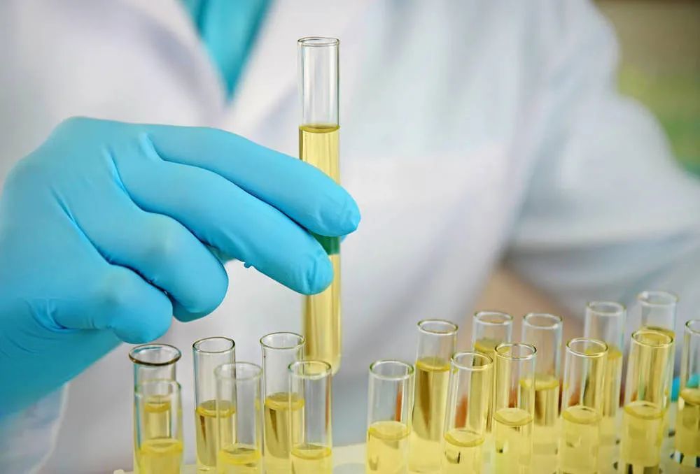 尿常规检查|做尿常规前一定要知道的7件事，当心没病变有病