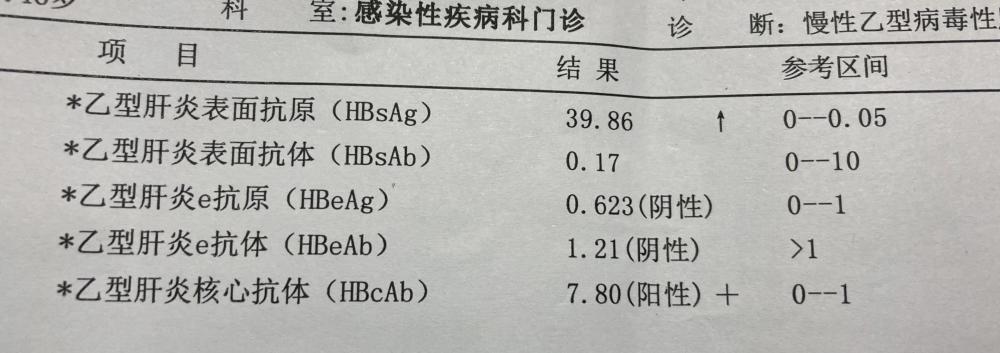 乙肝病毒e抗原2,乙肝表面抗體1,乙肝表面抗原乙肝兩對半或者說乙肝