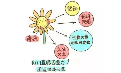 肛門痔瘡長什麼樣子哪些人群容易患上痔瘡