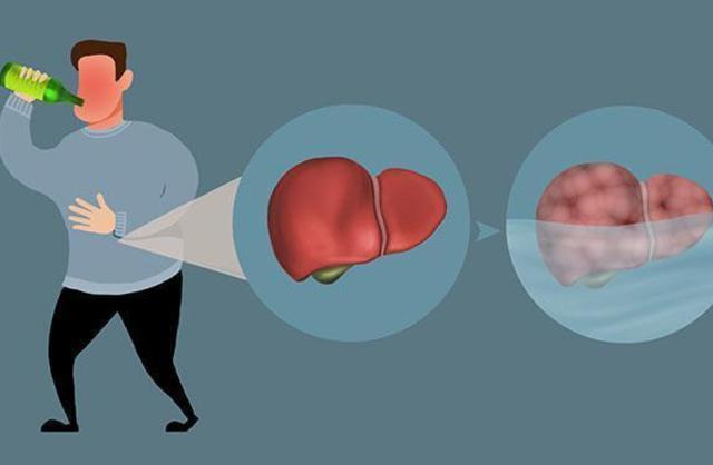 喝酒|经常喝酒的人要注意了，若是出现以下几种情况，或该考虑戒酒了