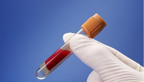 乙肝|乙肝新医学诊断技术研发，科学家多中心评估，一种体外设备