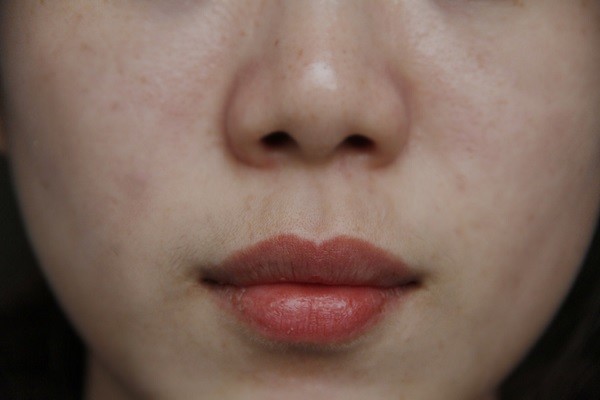 女性唇毛浓密,如何去除?唇毛会越刮越多吗?很多女性还蒙在鼓中