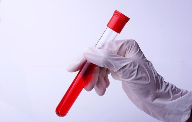 血压|血压、血脂、血糖、血尿酸参考值对照表，记得收藏