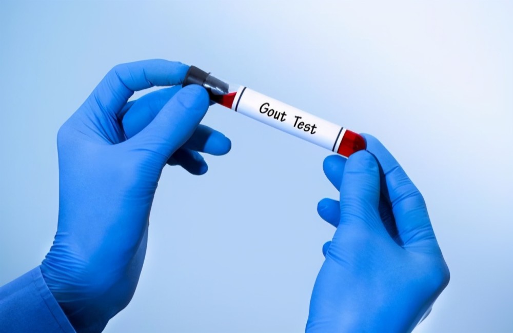 血压|血压、血脂、血糖、血尿酸参考值对照表，记得收藏