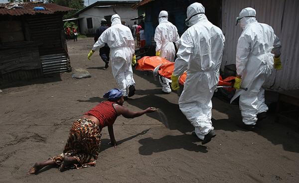 埃博拉出血热 病人图片
