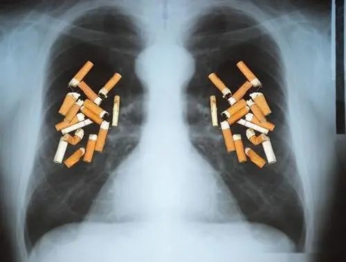 肺大泡能活多久图片