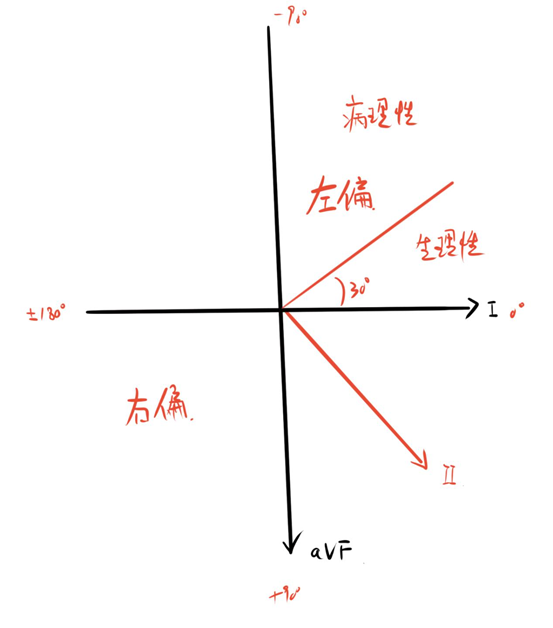 心电图基础思维方法论看完的都收藏了