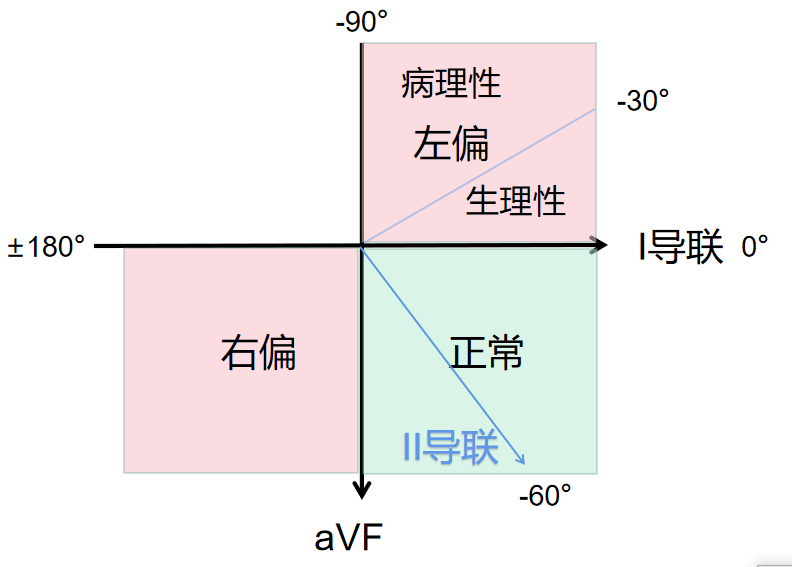 心电图基础思维方法论,看完的都收藏了_腾讯新闻