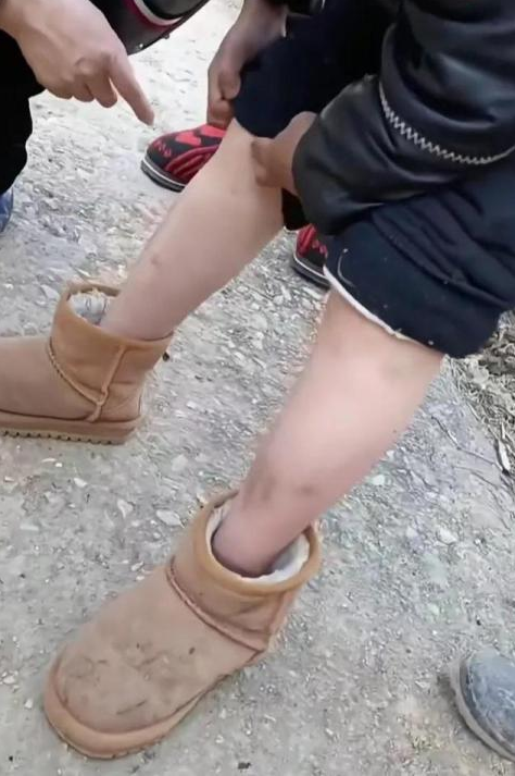 昔日网红成为残疾儿童,"小马云"范小勤身上到底发生了什么?