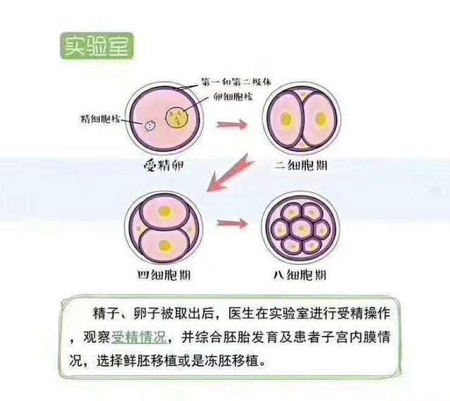 孕脉健康俄罗斯试管婴儿 什么样的俄罗斯试管婴儿胚胎才称得上优质胚胎 腾讯新闻
