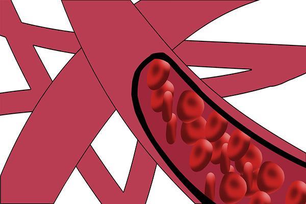 低密度胆固醇|胆固醇偏高怎么办？提醒：三件事常做，或许“坏”胆固醇会下降