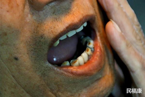 吸烟只吸前半截,能降低肺部损伤?