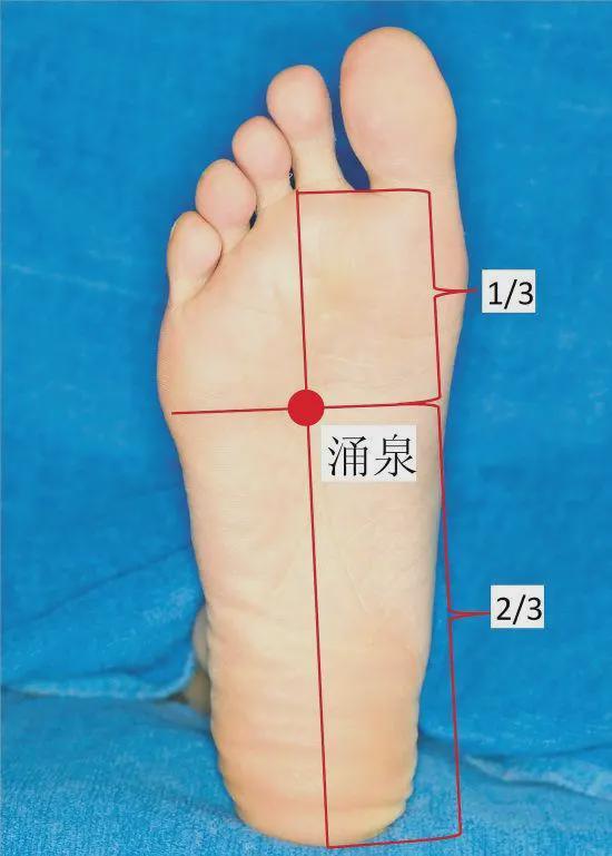 寻找涌泉穴最简单的方法就是用纵横线来定位,从我们的第二和第三趾的