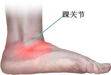 快把裤腿放下别等踝关节疼痛在后悔