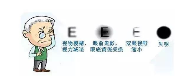 居家自测你有没有得白内障